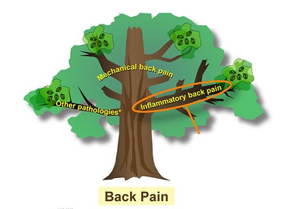 from: Unanswered questions in the management of axial spondyloarthritis: by Xenofon Baraliakos & Atul Deodhar.