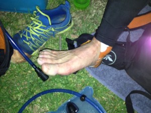 Errol's foot after 70km