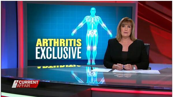 Arthritis Exclusive ACA