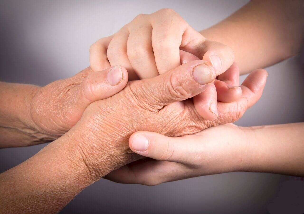 An Image of Hands with Rheumatoid Arthritis