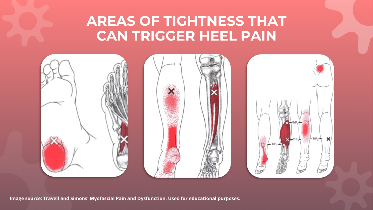 Plantar Fasciitis Rest, Stretch or Strengthen 1