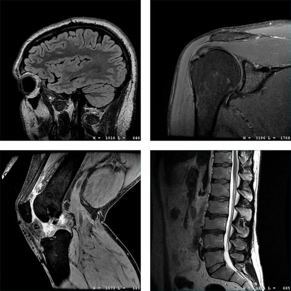 MRI Multiple