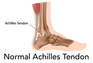 Normal Achilles Tendon Image